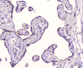 GM130/GOLGA2 Antibody
