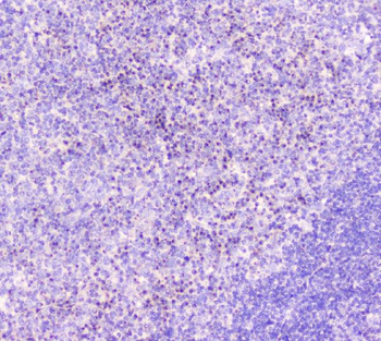 GM130/GOLGA2 Antibody