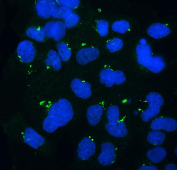 GOLPH3 Rabbit Polyclonal Antibody