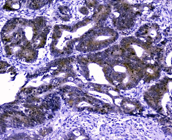 GOLPH3 Rabbit Polyclonal Antibody