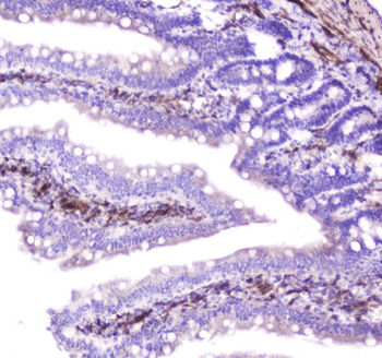 Hsp27/Hspb1 Antibody
