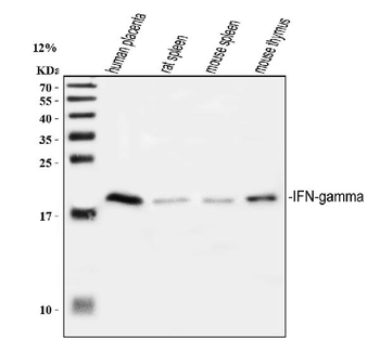 Interferon gamma/IFNG Antibody