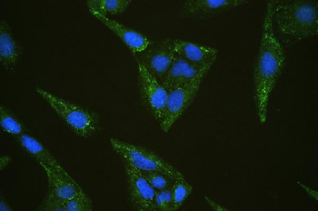 INPPL1 Antibody