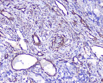 INPPL1 Antibody