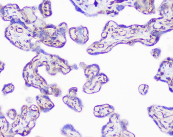 INPPL1 Antibody