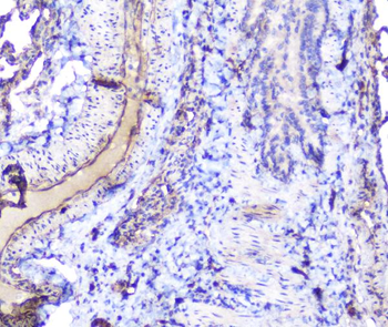INPPL1 Antibody