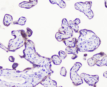 LATS1 Rabbit Polyclonal Antibody