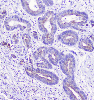 LATS1 Rabbit Polyclonal Antibody
