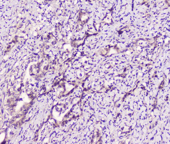 LATS1 Rabbit Polyclonal Antibody