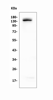 LATS1 Rabbit Polyclonal Antibody