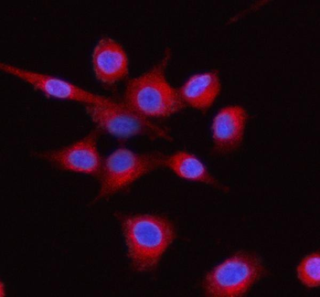 LMAN1 Rabbit Polyclonal Antibody