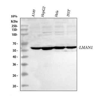LMAN1 Rabbit Polyclonal Antibody