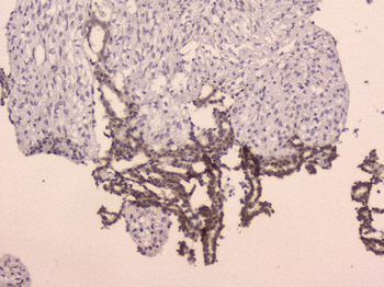 LRIG1 Rabbit Polyclonal Antibody