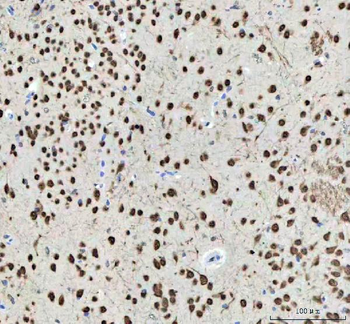 Nova1 Antibody