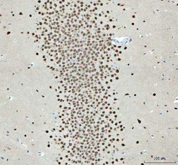 Nova1 Antibody