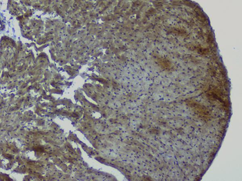 NRF1 Antibody