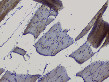 NRF1 Antibody