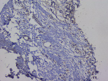 NRF1 Antibody