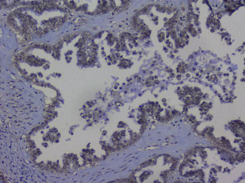 NRF1 Antibody