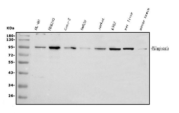 Plasminogen/PLG Rabbit Polyclonal Antibody