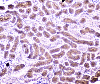 PON1 Rabbit Polyclonal Antibody