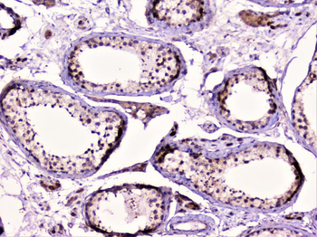 Rad51 Antibody