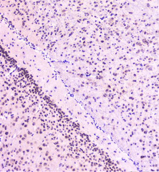 Rad51 Antibody