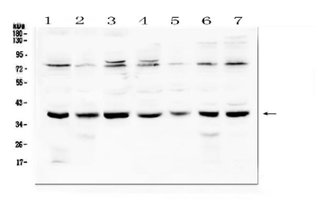 Rad51 Antibody