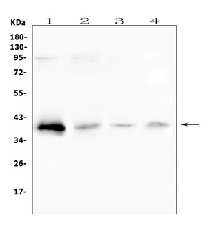 RP2 Antibody