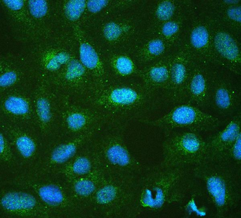 RP2 Antibody