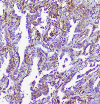 RP2 Antibody