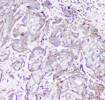 RP2 Antibody