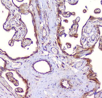 RP2 Antibody