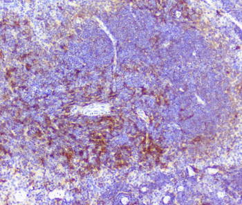 RP2 Antibody