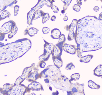 RPS3 Rabbit Polyclonal Antibody