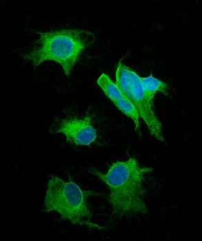 SNAP25 Rabbit Polyclonal Antibody