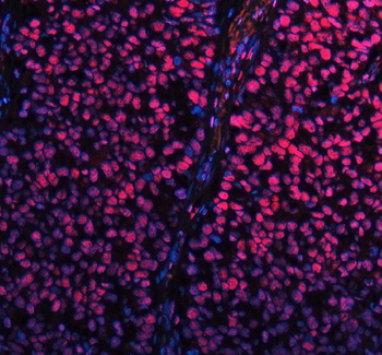 SP1 Antibody