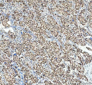 SP1 Antibody
