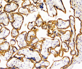 TANK Antibody