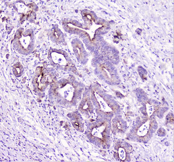 TANK Antibody