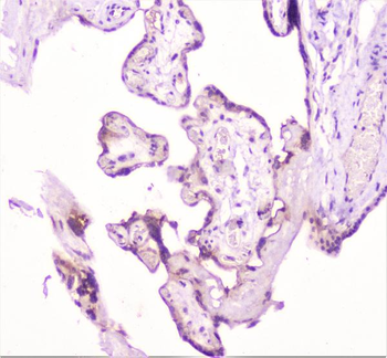 TANK Antibody