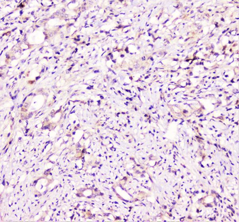 TANK Antibody