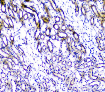TANK Antibody