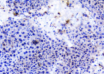 TANK Antibody