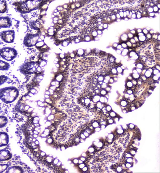 TANK Antibody