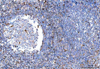 TCR alpha/TRAC Rabbit Polyclonal Antibody