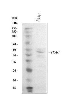 TCR alpha/TRAC Rabbit Polyclonal Antibody