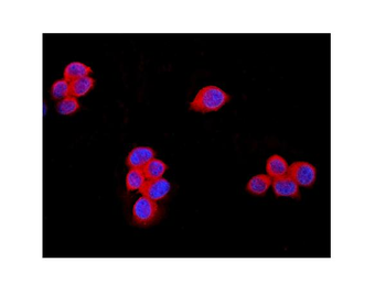 TRPM7 Rabbit Polyclonal Antibody