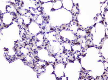 UBE2I UBC9 Antibody