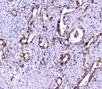 UBE2I UBC9 Antibody